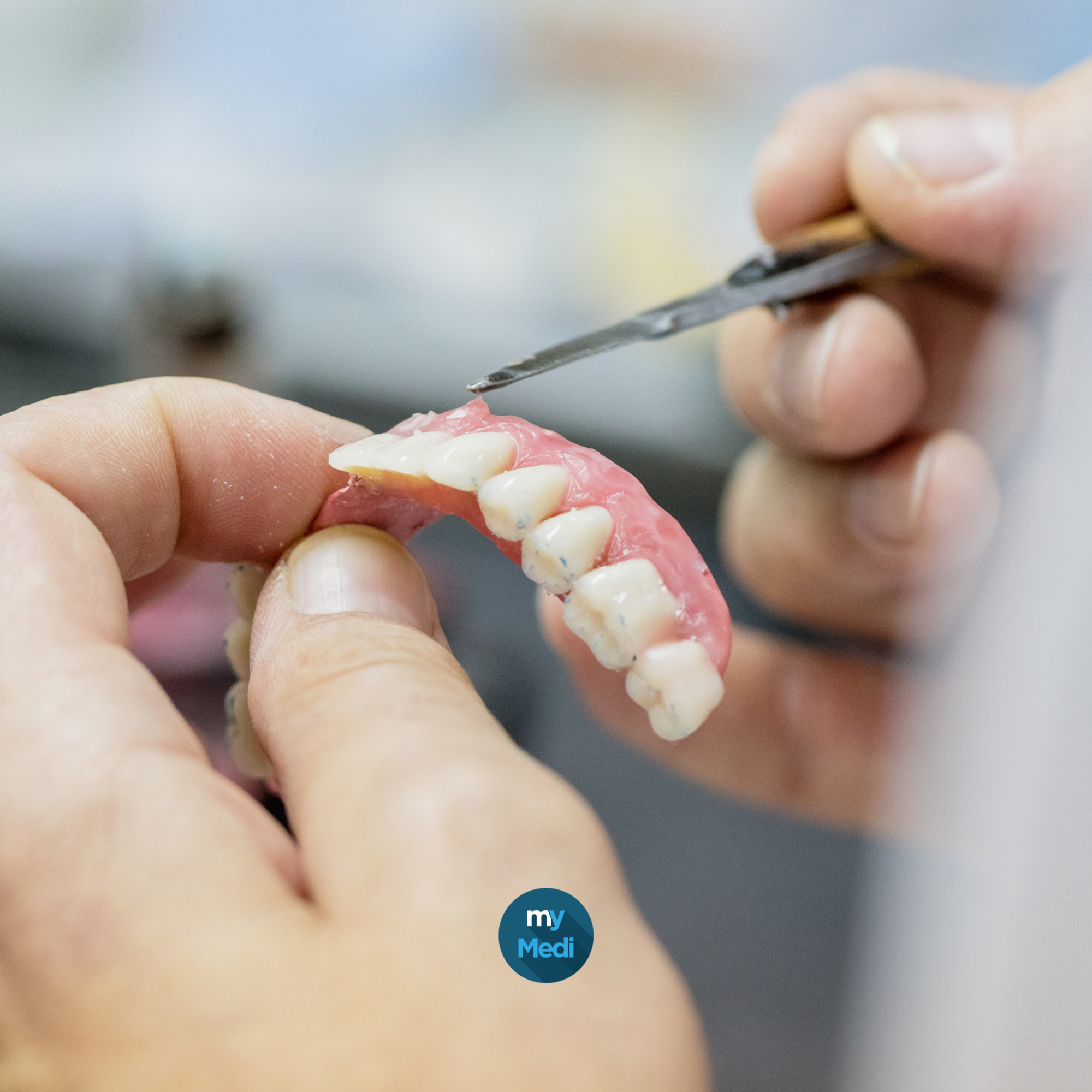 Réparation prothèse