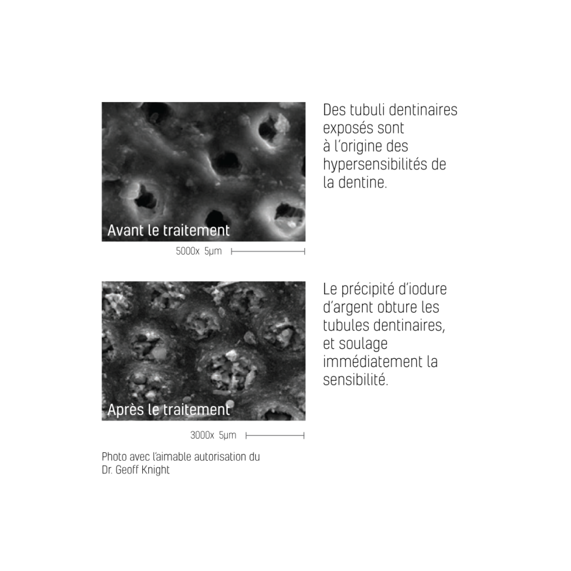 Désensibilisant dentaire Riva Star - flacons/kit capsules - SDI