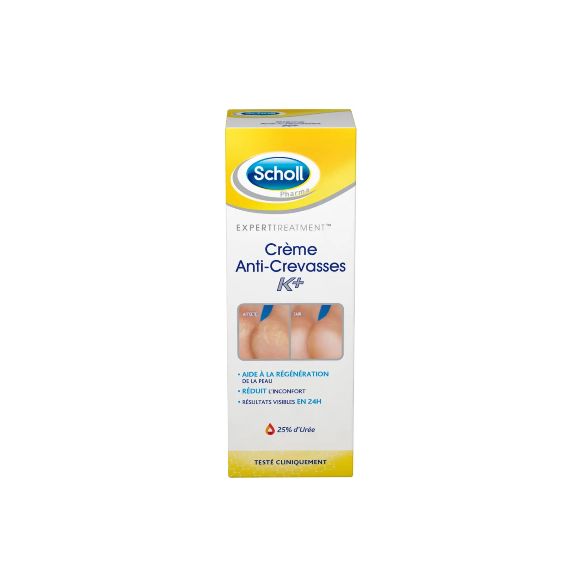 Crème Anti-Crevasses K+ Urée 25% - 2 contenances - Scholl - My Médical