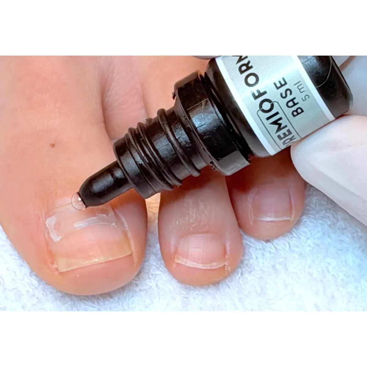 Kit complet de correction pour Orthonyxie - Premioform