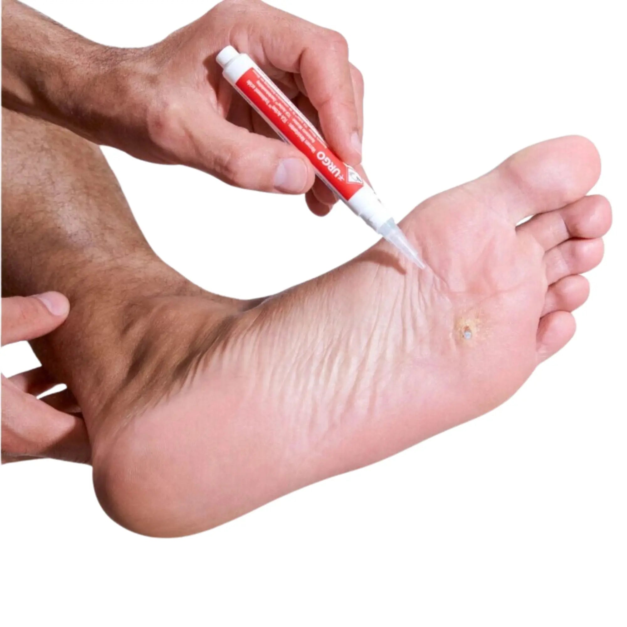 Stylo pour traitement des verrues résistantes - 2 ml - Urgo Urgo