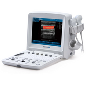 U50 Color Ultrasound Scanner - EDAN