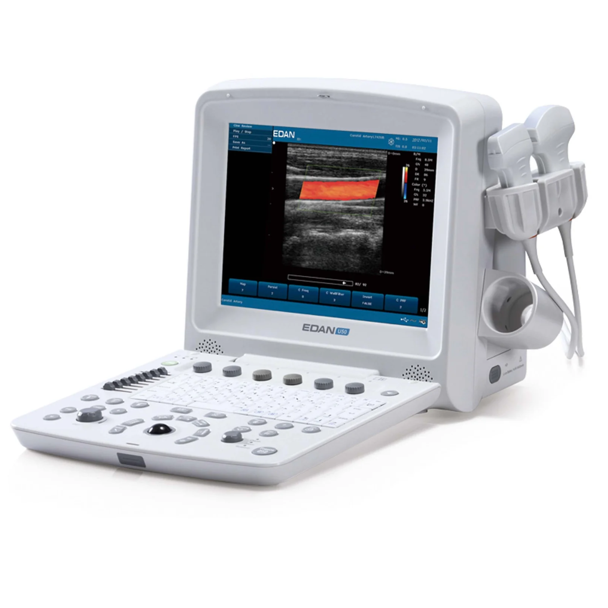 U50 Color Ultrasound Scanner - EDAN